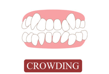 CROWDING