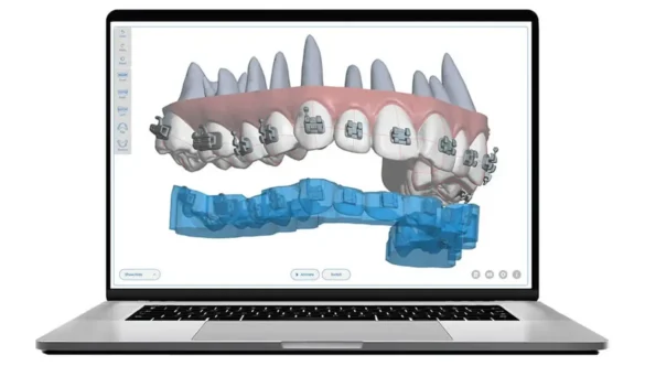 Advanced Technology Speeds Up Treatment