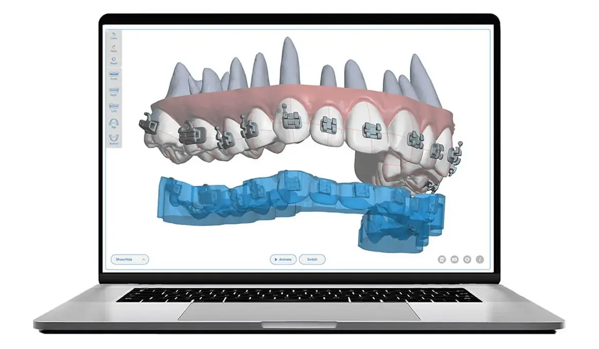 Advanced Technology Speeds Up Treatment