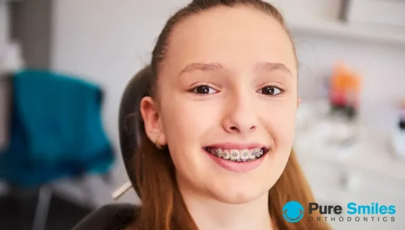 How to Survive Your First Week in Braces