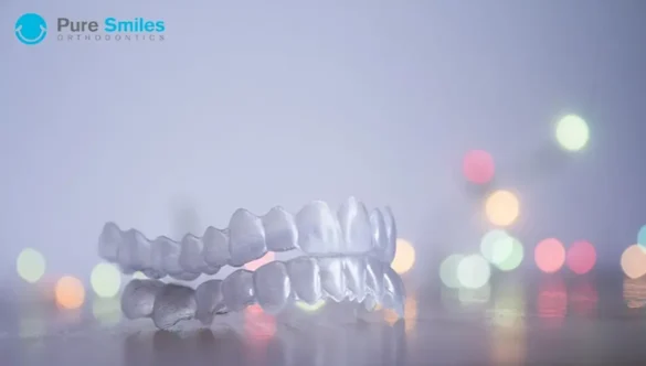 Tips to Avoid Invisalign Irritation