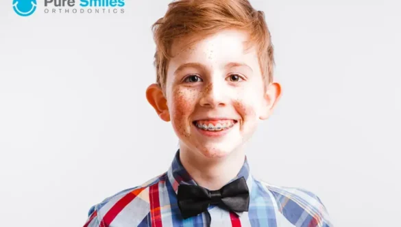 Everything You Need to Know About Children’s Orthodontics in Austin