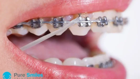 Don’t Skip Those Rubber Bands