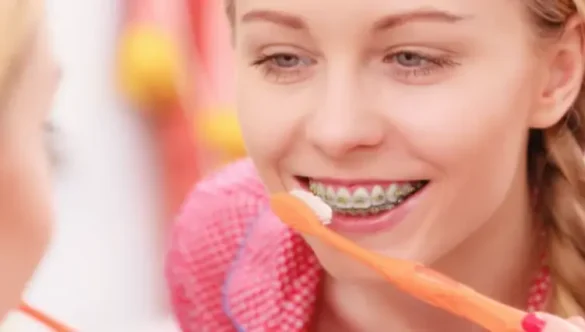 How to Brush Your Teeth When You Have Braces