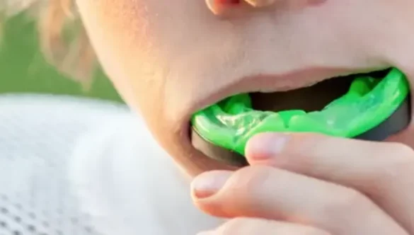 Playing Sports with Braces