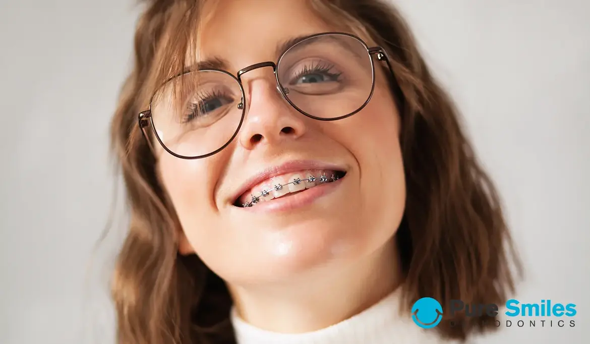 Exploring Your Braces Options in Adulthood