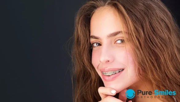 Little Known Facts About Adult Orthodontics