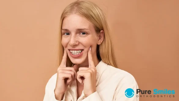 Will Braces Change My Face Shape?