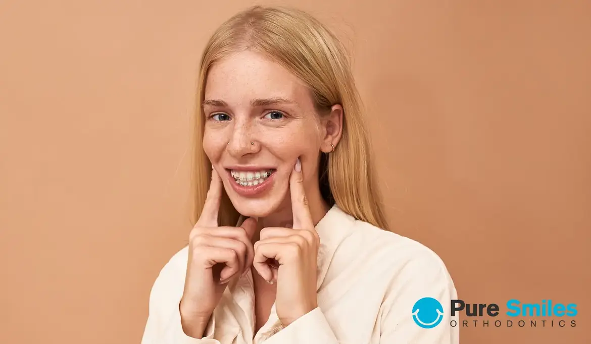 Will Braces Change My Face Shape?