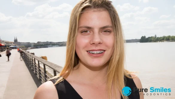 Your Braces Summer Survival Guide