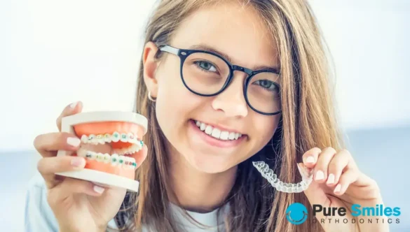 What are the Differences Between Braces and Clear Aligners?