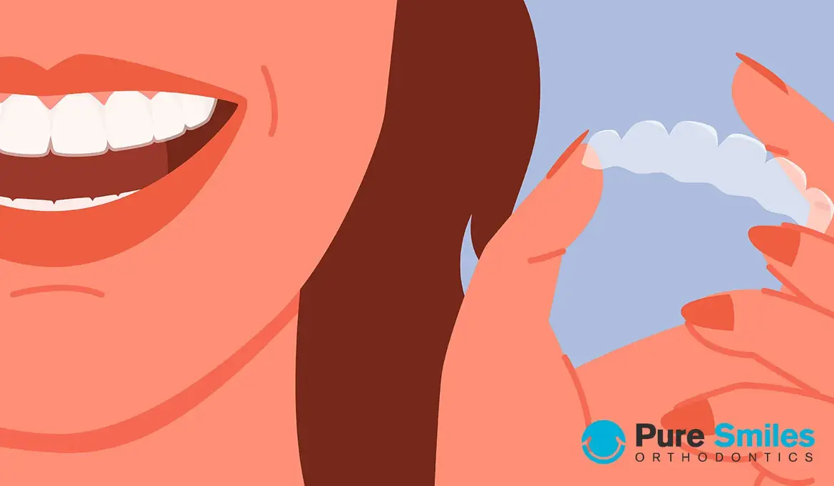 How Do I Clean My Aligners?