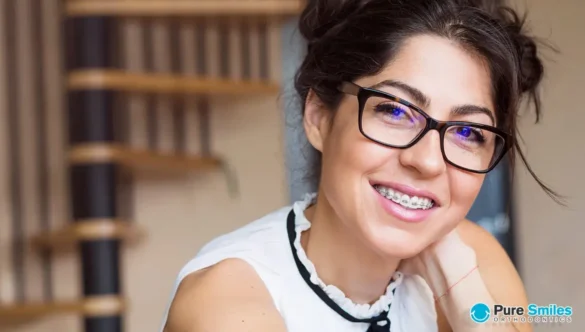 Getting Braces a Second Time