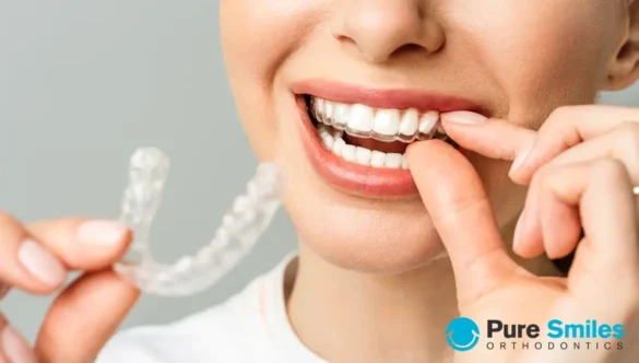 How Much Is Invisalign Treatment Without Insurance?