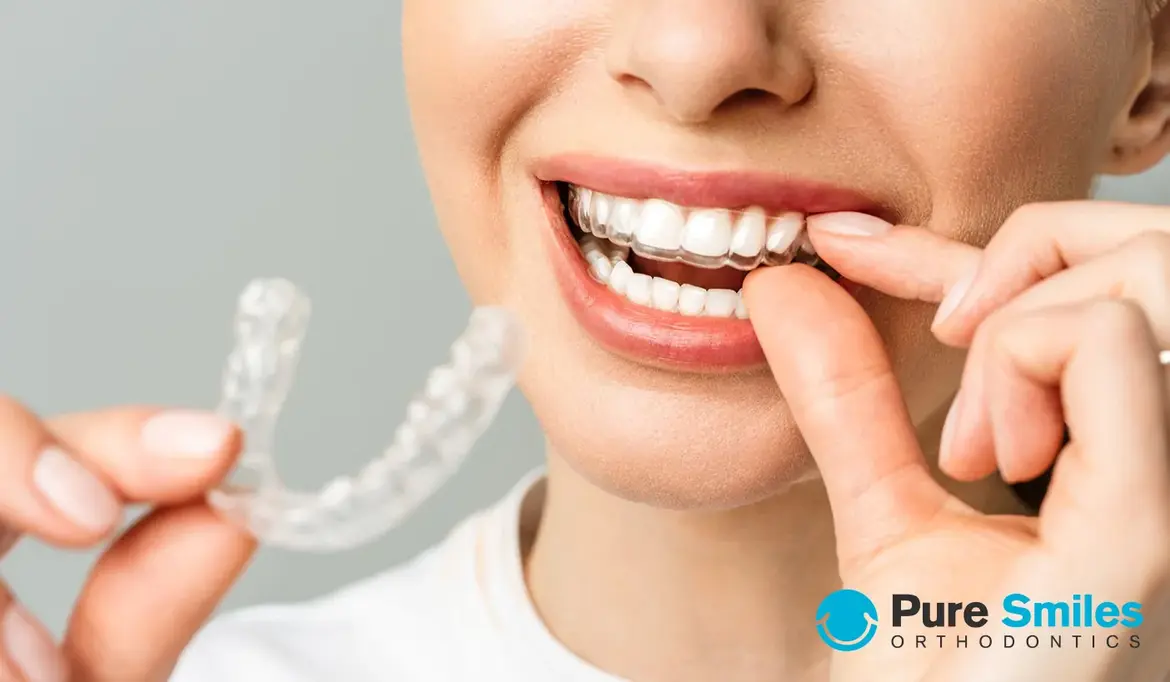 How Much Is Invisalign Treatment Without Insurance?