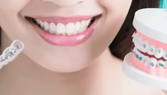 Why Summer Is a Great Time to Start Invisalign Teen or Braces