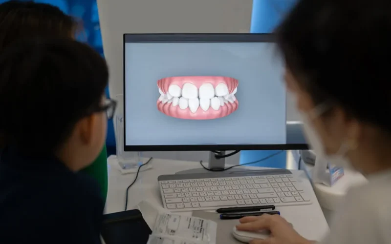 invisalign-treatment-plan-1024x683