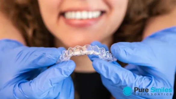 Oh No – My Retainer Feels Tight!