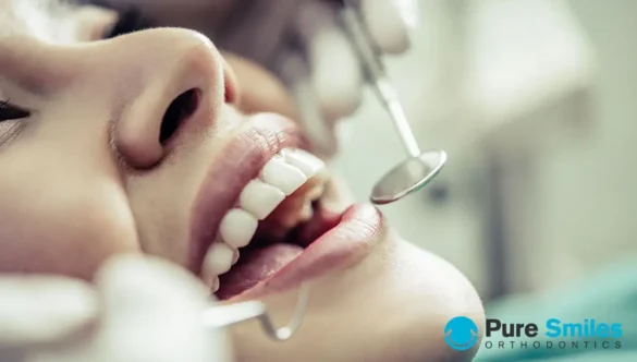 Do I Still Need to See My Dentist During Orthodontic Treatment?