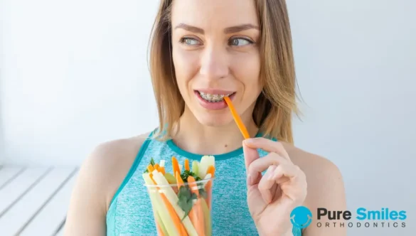 Foods to Avoid During Braces