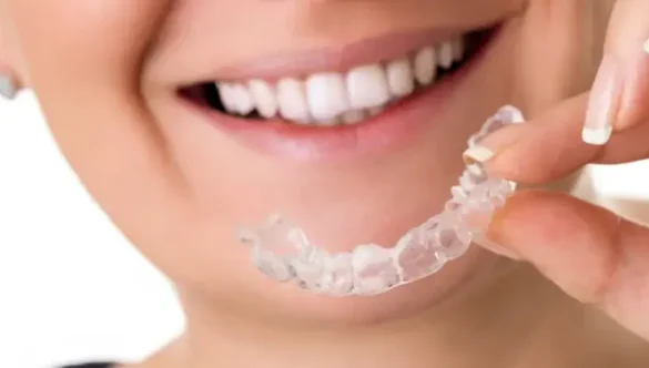 Braces vs. Invisalign